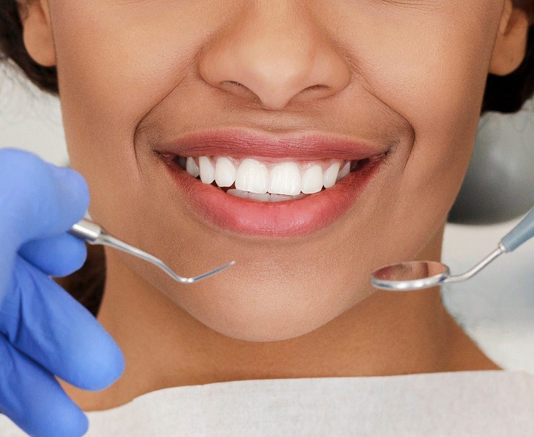 Close-up of a woman smiling during a dental exam, with a dentist’s gloved hands holding dental tools near her mouth.
